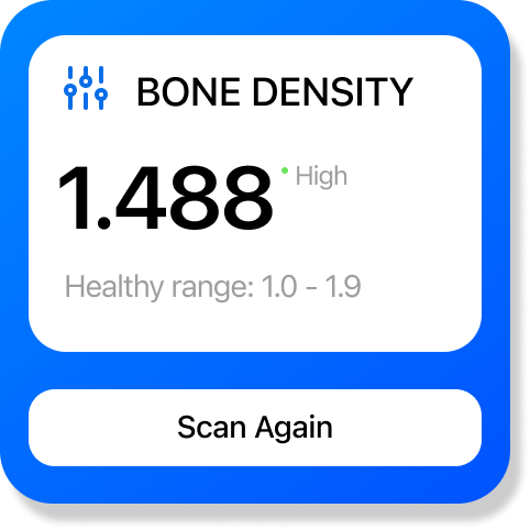 Bone Density